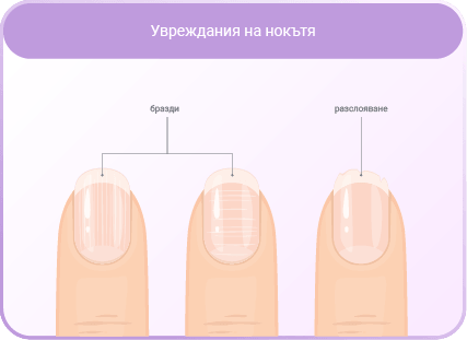 Укрепване на ноктите